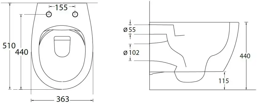 Подвесной безободковый унитаз Allen Brau Fantasy 4.11004.AN без сиденья, антрацит фото 2
